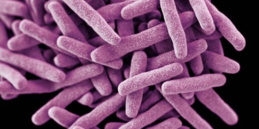 TB-Bacteria-1